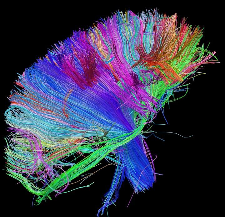 Neural Map of a Brain